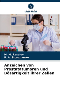 Anzeichen von Prostatatumoren und Bösartigkeit ihrer Zellen