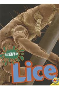 Lice