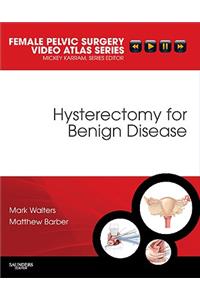 Hysterectomy for Benign Disease