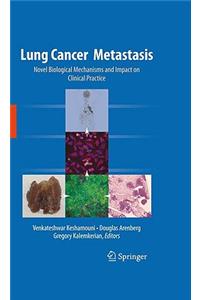 Lung Cancer Metastasis: Novel Biological Mechanisms and Impact on Clinical Practice