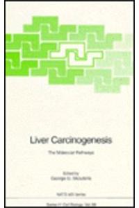 Liver Carcinogenesis