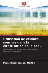 Utilisation de cellules souches dans la cicatrisation de la peau