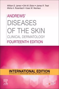 Andrews' Diseases of the Skin, International Edition: Clinical Dermatology, 14e