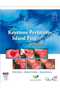 The Keystone Island Flap Concept in Reconstructive Surgery