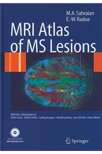 MRI Atlas of MS Lesions