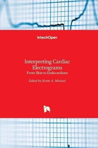 Interpreting Cardiac Electrograms