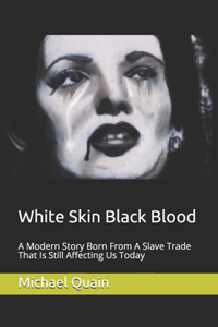 White Skin Black Blood: A Modern Story Born From A Slave Trade That Is Still Affecting Us Today