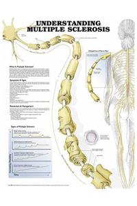 Understanding Multiple Sclerosis Anatomical Chart