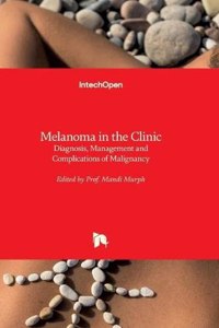 Melanoma in the Clinic