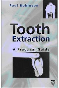 Tooth Extraction