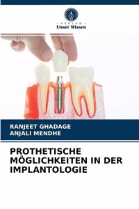 Prothetische Möglichkeiten in Der Implantologie