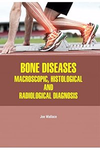 BONE DISEASES: MACROSCOPIC, HISTOLOGICAL AND RADIOLOGICAL DIAGNOSIS(HB)
