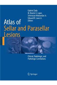 Atlas of Sellar and Parasellar Lesions