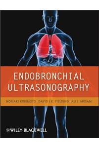 Endobronchial Ultrasonography