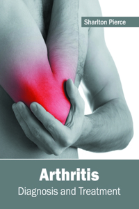 Arthritis: Diagnosis and Treatment