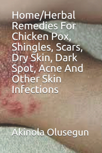 Home/Herbal Remedies For Chicken Pox, Shingles, Scars, Dry Skin, Dark Spot, Acne And Other Skin Infections