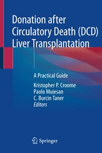 Donation after Circulatory Death (DCD) Liver Transplantation