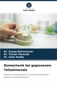 Biomechanik bei gegossenem Teilzahnersatz