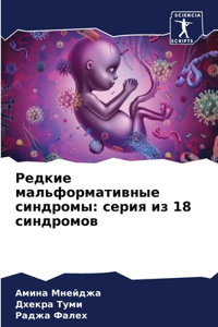 Редкие мальформативные синдромы