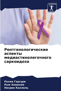 Рентгенологические аспекты медиастино&