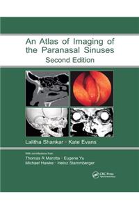Atlas of Imaging of the Paranasal Sinuses