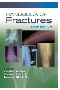 Handbook of Fractures