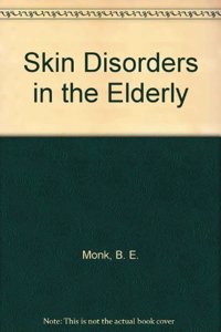 Skin Diseases In Elderly
