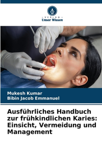 Ausführliches Handbuch zur frühkindlichen Karies