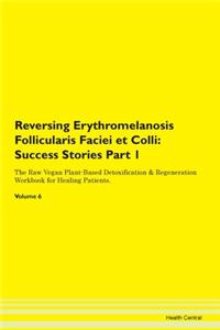 Reversing Erythromelanosis Follicularis