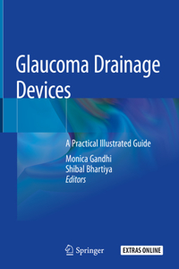 Glaucoma Drainage Devices: A Practical Illustrated Guide