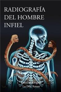 Radiografia del Hombre Infiel