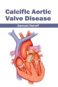 Calcific Aortic Valve Disease