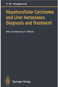 Hepatocellular Carcinoma and Liver Metastases