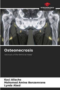 Osteonecrosis