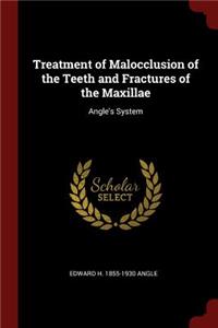 Treatment of Malocclusion of the Teeth and Fractures of the Maxillae
