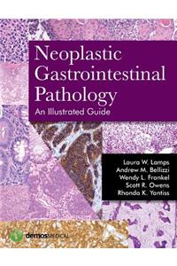 Neoplastic Gastrointestinal Pathology: An Illustrated Guide