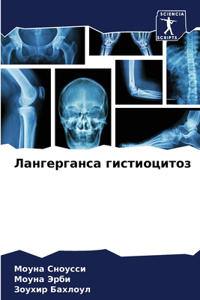 Лангерганса гистиоцитоз