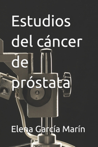 Estudios del cáncer de próstata