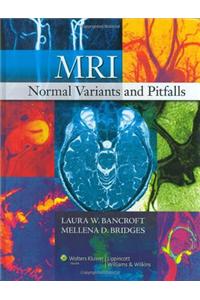 MRI Normal Variants and Pitfalls