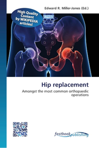 Hip replacement