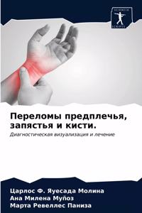 Переломы предплечья, запястья и кисти.