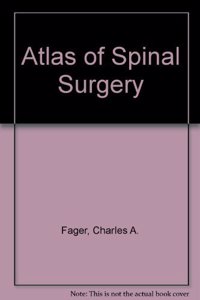 Atlas of Spinal Surgery