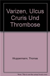 Varizen, Ulcus Cruris Und Thrombose