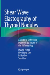 Shear Wave Elastography of Thyroid Nodules