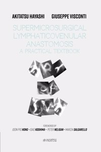 Supermicrosurgical LymphaticoVenular Anastomosis