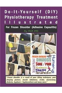 Physiotherapy Treatment Illustrated for Frozen Shoulder (Adhesive Capsulitis)