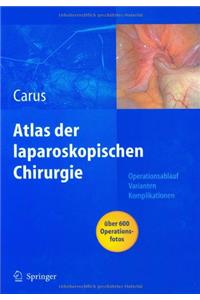 Atlas Laparoskopische Chirurgie