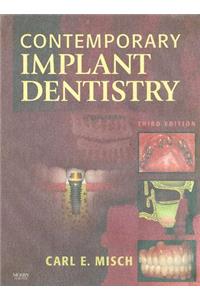 Contemporary Implant Dentistry