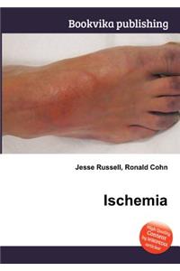 Ischemia