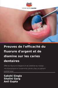 Preuves de l'efficacité du fluorure d'argent et de diamine sur les caries dentaires